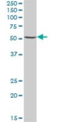 Western Blot: UDP glucose dehydrogenase Antibody [H00007358-B01P]