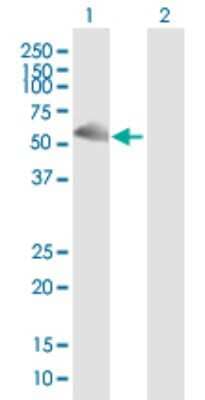Western Blot: UDP glucose dehydrogenase Antibody [H00007358-B01P]