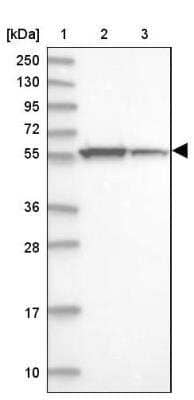 Western Blot: UDP glucose dehydrogenase Antibody [NBP1-90906]