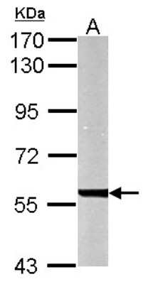 Western Blot: UDP glucose dehydrogenase Antibody [NBP2-20798]
