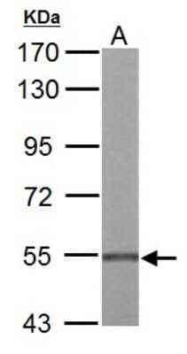 Western Blot: UDP glucose dehydrogenase Antibody [NBP2-20798]