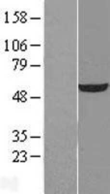 Western Blot: UDP glucose dehydrogenase Overexpression Lysate [NBL1-17594]