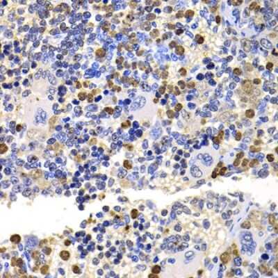 Immunohistochemistry-Paraffin: UEV2 Antibody - BSA Free [NBP2-95241]