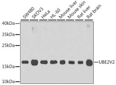 Western Blot: UEV2 AntibodyBSA Free [NBP2-95241]