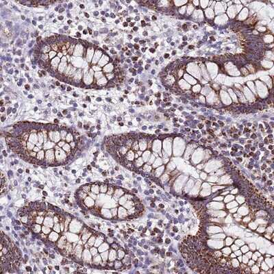 Immunohistochemistry-Paraffin: UEVLD Antibody [NBP1-92561]