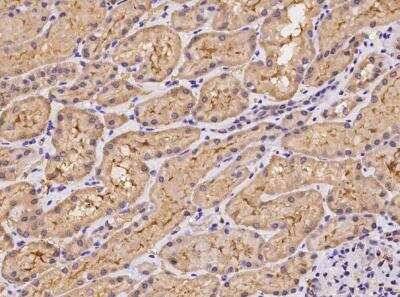 Immunohistochemistry-Paraffin: UEVLD Antibody [NBP3-05953]