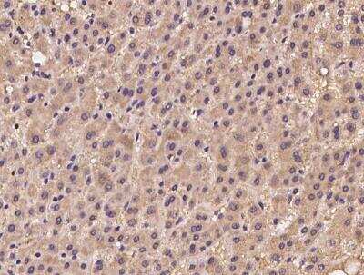 Immunohistochemistry-Paraffin: UEVLD Antibody [NBP3-05953]