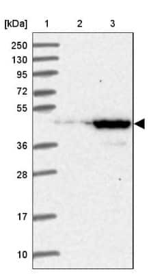 Western Blot: UEVLD Antibody [NBP1-92561]