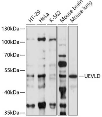 Western Blot: UEVLD AntibodyAzide and BSA Free [NBP2-93991]