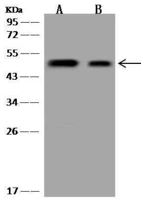 Western Blot: UEVLD Antibody [NBP3-05953]