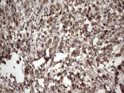 Immunohistochemistry: UFD1L Antibody (OTI8G6) [NBP2-46289]
