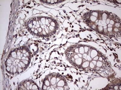 Immunohistochemistry: UFD1L Antibody (OTI8G6) [NBP2-46289]