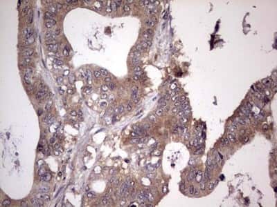 Immunohistochemistry: UFD1L Antibody (OTI8G6) [NBP2-46289]