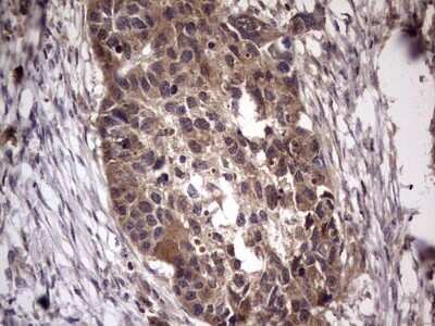 Immunohistochemistry: UFD1L Antibody (OTI8G6) [NBP2-46289]