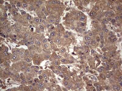 Immunohistochemistry: UFD1L Antibody (OTI8G6) [NBP2-46289]