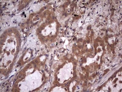 Immunohistochemistry: UFD1L Antibody (OTI8G6) [NBP2-46289]