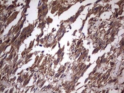 Immunohistochemistry: UFD1L Antibody (OTI8G6) [NBP2-46289]