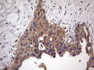 Immunohistochemistry: UFD1L Antibody (OTI8G6) [NBP2-46289]