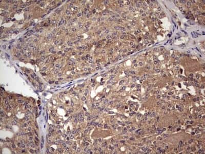 Immunohistochemistry: UFD1L Antibody (OTI8G6) [NBP2-46289]