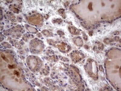Immunohistochemistry: UFD1L Antibody (OTI8G6) [NBP2-46289]