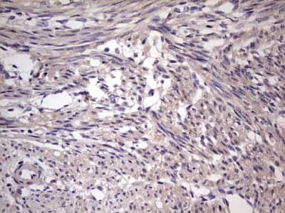 Immunohistochemistry: UFD1L Antibody (OTI8G6) [NBP2-46289]