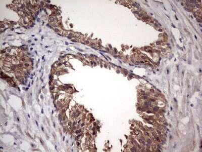Immunohistochemistry: UFD1L Antibody (OTI8G6) [NBP2-46289]
