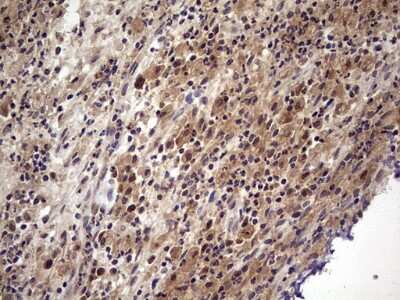 Immunohistochemistry: UFD1L Antibody (OTI8G6) [NBP2-46289]