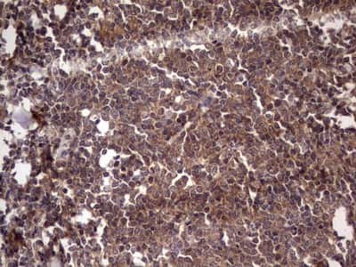 Immunohistochemistry: UFD1L Antibody (OTI8G6) [NBP2-46289]