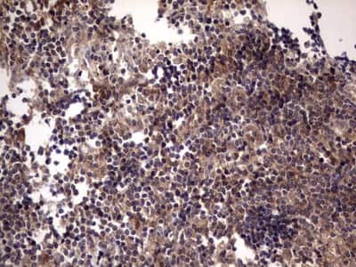 Immunohistochemistry: UFD1L Antibody (OTI8G6) [NBP2-46289]