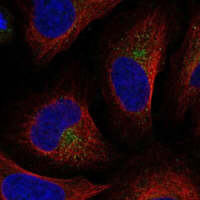 Immunocytochemistry/ Immunofluorescence: UFD1L Antibody [NBP2-56188]