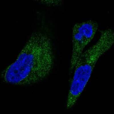 Immunocytochemistry/ Immunofluorescence: UFD1L Antibody [NBP2-57902]