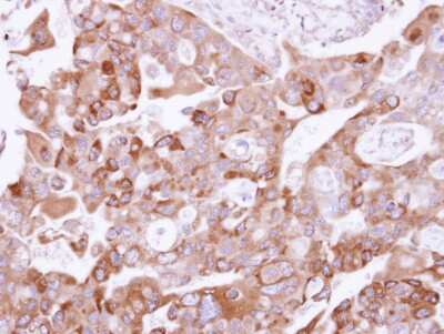 Immunohistochemistry-Paraffin: UFD1L Antibody [NBP1-32777]