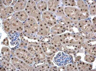 Immunohistochemistry-Paraffin: UFD1L Antibody [NBP1-32777]