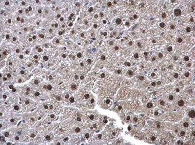 Immunohistochemistry-Paraffin: UFD1L Antibody [NBP1-32777]