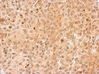 Immunohistochemistry-Paraffin: UFD1L Antibody [NBP2-20802]