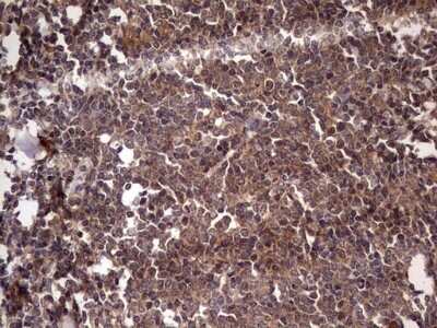 Immunohistochemistry: UFD1L Antibody (OTI8G6) - Azide and BSA Free [NBP2-74781]