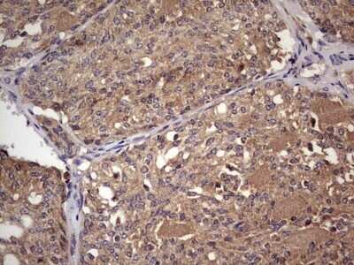 Immunohistochemistry: UFD1L Antibody (OTI8G6) - Azide and BSA Free [NBP2-74781]