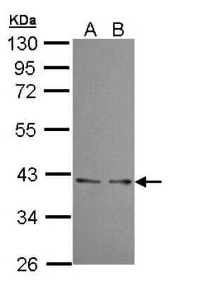 Western Blot: UFD1L Antibody [NBP1-32777]