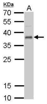 Western Blot: UFD1L Antibody [NBP1-32777]