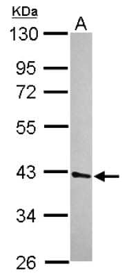 Western Blot: UFD1L Antibody [NBP2-20802]