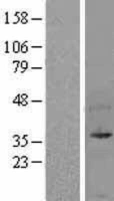 Western Blot: UFD1L Overexpression Lysate [NBL1-17588]