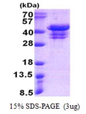 SDS-PAGE: Recombinant Human UFD1L His Protein [NBP2-22920]