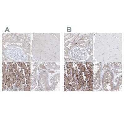 Immunohistochemistry-Paraffin: UFL1 Antibody [NBP1-90691]