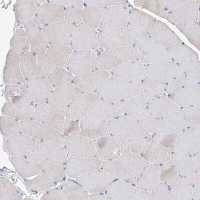 Immunohistochemistry-Paraffin: UFL1 Antibody [NBP1-90691]