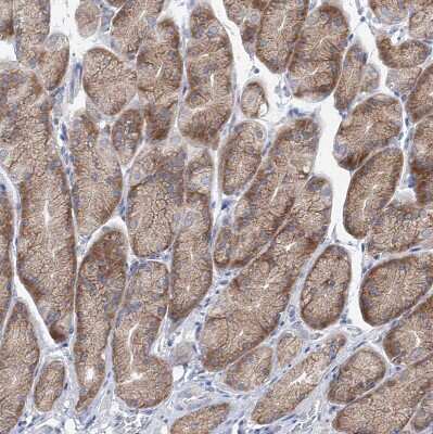 Immunohistochemistry-Paraffin: UFL1 Antibody [NBP1-90691]