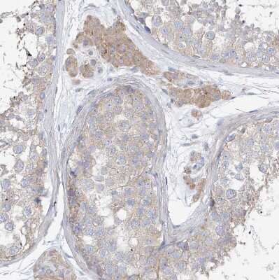 Immunohistochemistry-Paraffin: UFL1 Antibody [NBP1-90691]