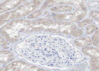 Immunohistochemistry-Paraffin: UFL1 Antibody [NBP1-90691]