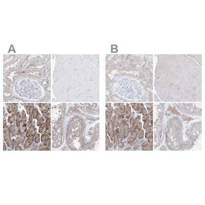Immunohistochemistry-Paraffin: UFL1 Antibody [NBP1-90692]