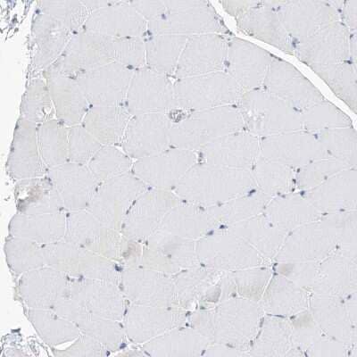 Immunohistochemistry-Paraffin: UFL1 Antibody [NBP1-90692]