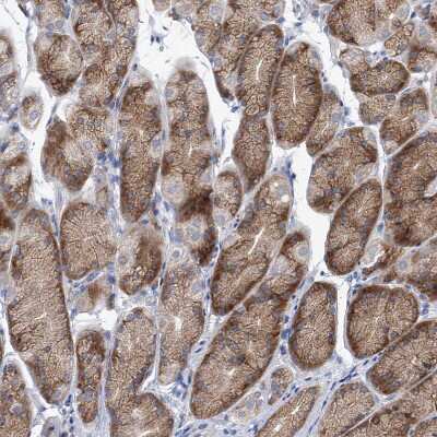 Immunohistochemistry-Paraffin: UFL1 Antibody [NBP1-90692]